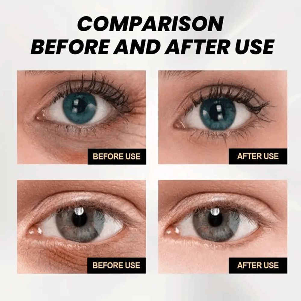 Temporary Eye Tightener Eye Cream - Picture 6 of 9
